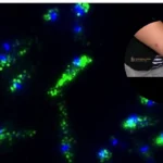 Leishmania parasites and their viruses